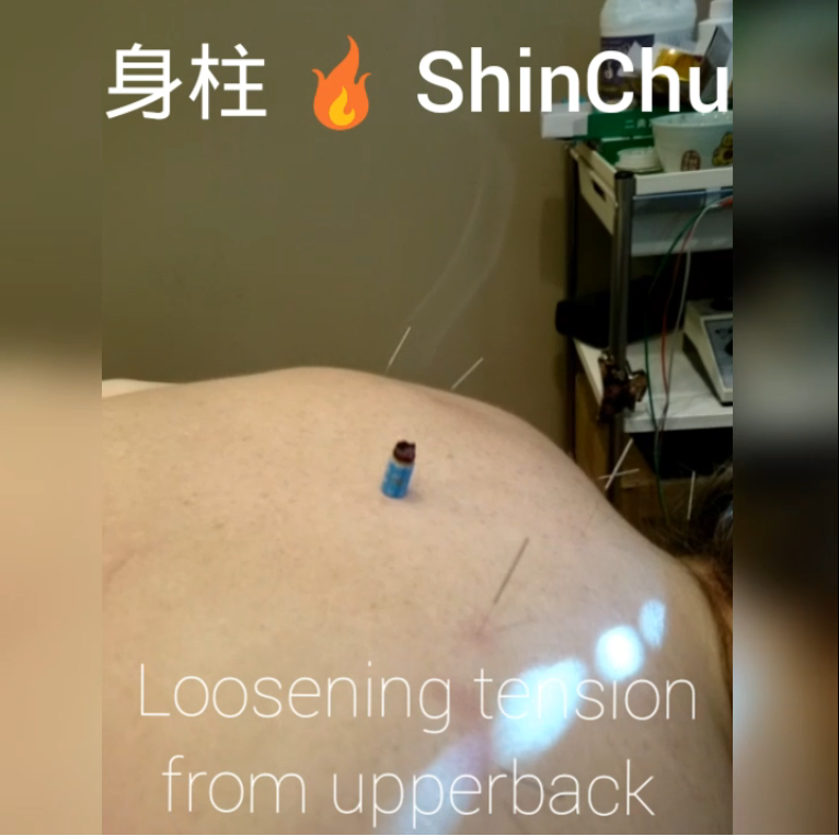 Stick-On Moxa on ShinChu, Body Piller